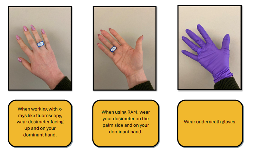 Proper way to wear ring dosimetry