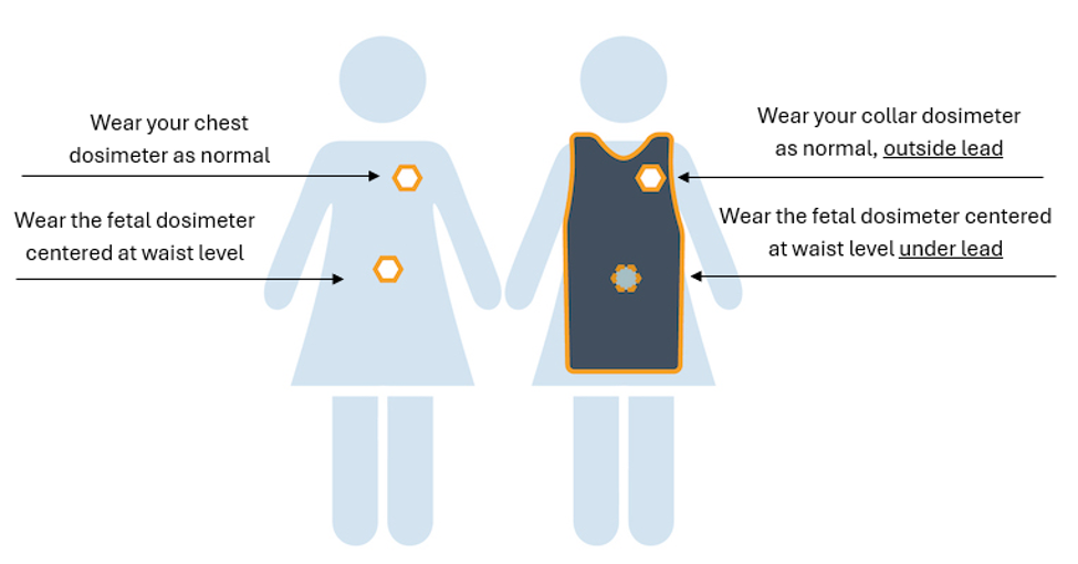 Proper way to wear fetal dosimetry